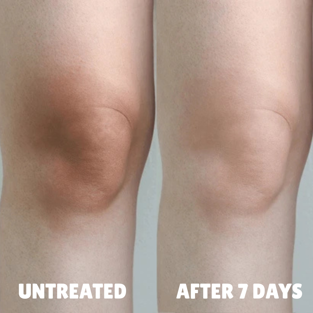 Ultra Strength Hyperpigmentation Brightening Cream