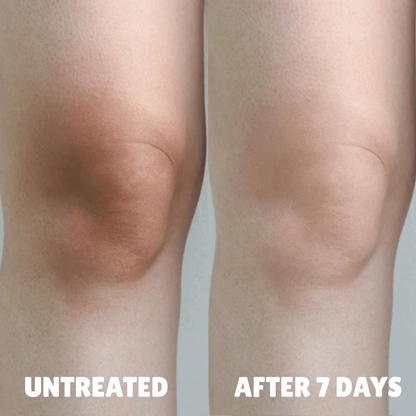 Ultra Strength Hyperpigmentation Brightening Cream